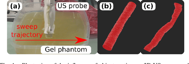 Figure 1 for Motion-Aware Robotic 3D Ultrasound