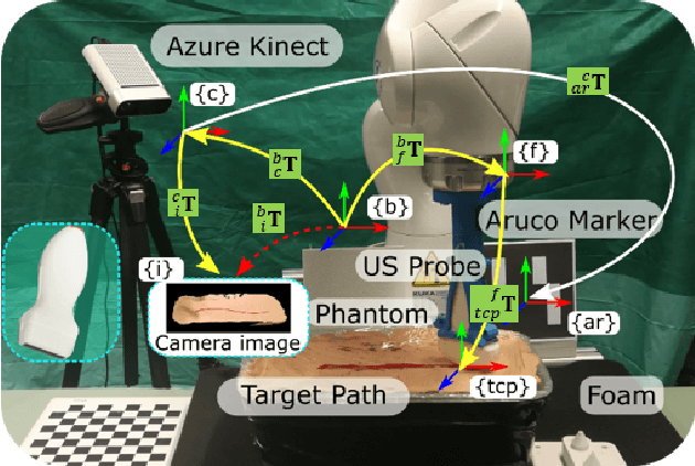 Figure 3 for Motion-Aware Robotic 3D Ultrasound