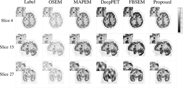 Figure 3 for TransEM:Residual Swin-Transformer based regularized PET image reconstruction