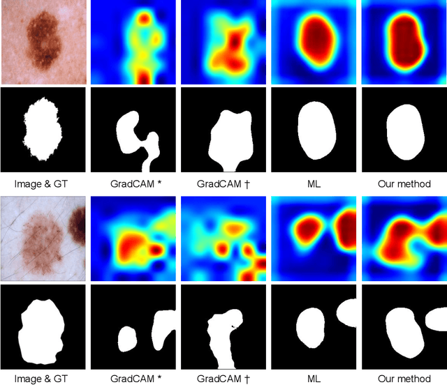 Figure 3 for Manifold-driven Attention Maps for Weakly Supervised Segmentation