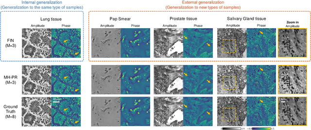 Figure 3 for Fourier Imager Network : A deep neural network for hologram reconstruction with superior external generalization
