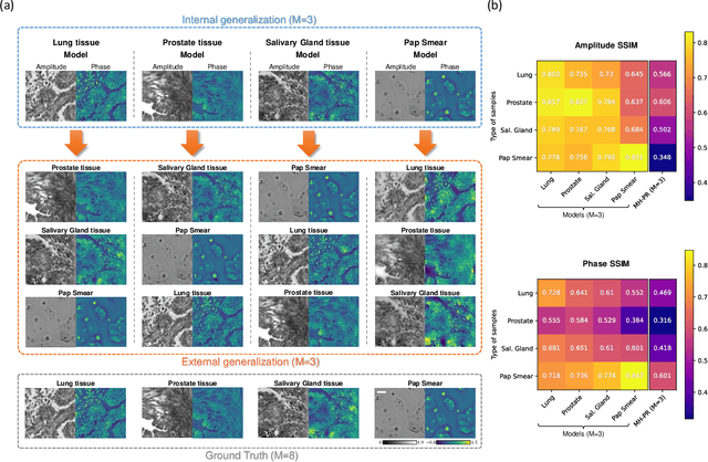 Figure 4 for Fourier Imager Network (FIN): A deep neural network for hologram reconstruction with superior external generalization