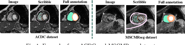 Figure 1 for ShapePU: A New PU Learning Framework Regularized by Global Consistency for Scribble Supervised Cardiac Segmentation