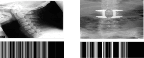 Figure 3 for Radon-Gabor Barcodes for Medical Image Retrieval