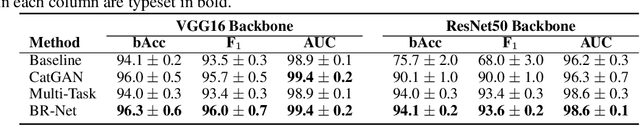 Figure 4 for Bias-Resilient Neural Network