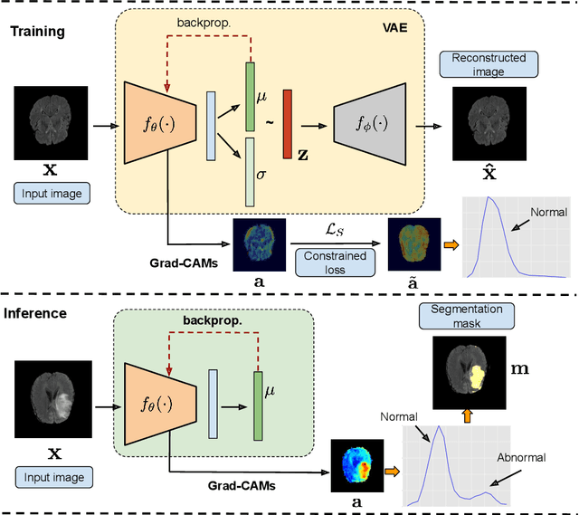 Figure 1 for Looking at the whole picture: constrained unsupervised anomaly segmentation