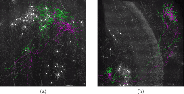 Figure 3 for Quality Control of Neuron Reconstruction Based on Deep Learning