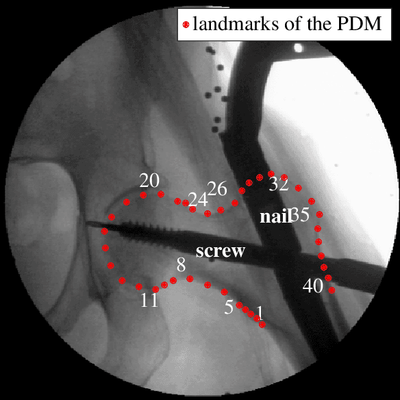 Figure 1 for A weighting strategy for Active Shape Models