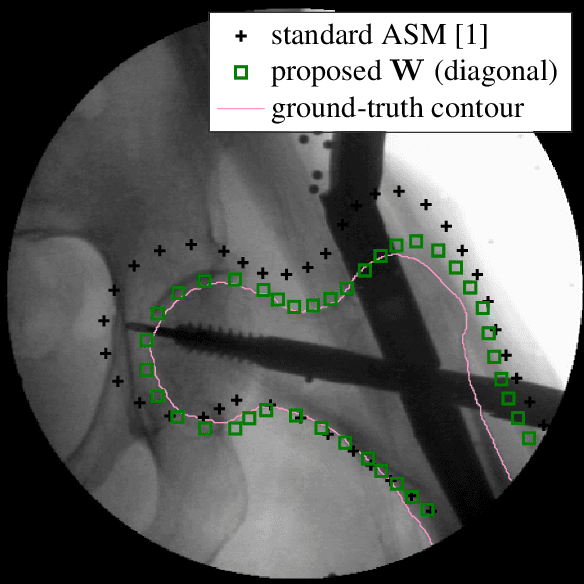 Figure 3 for A weighting strategy for Active Shape Models