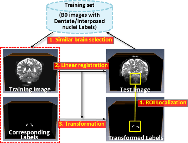 Figure 1 for Deep Cerebellar Nuclei Segmentation via Semi-Supervised Deep Context-Aware Learning from 7T Diffusion MRI