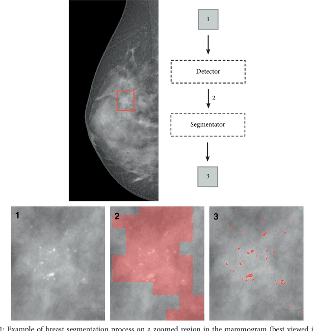 Figure 1 for Convolutional Neural Networks for the segmentation of microcalcification in Mammography Imaging