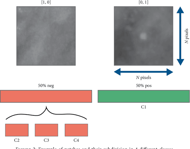 Figure 3 for Convolutional Neural Networks for the segmentation of microcalcification in Mammography Imaging