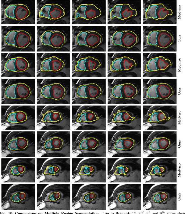 Figure 2 for Tracking via Motion Estimation with Physically Motivated Inter-Region Constraints