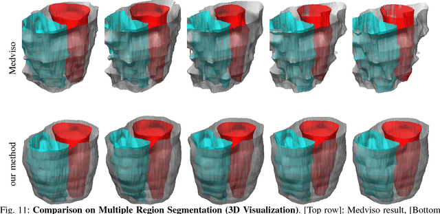 Figure 3 for Tracking via Motion Estimation with Physically Motivated Inter-Region Constraints