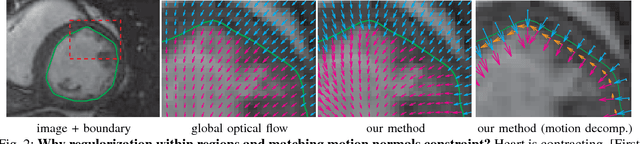 Figure 4 for Tracking via Motion Estimation with Physically Motivated Inter-Region Constraints
