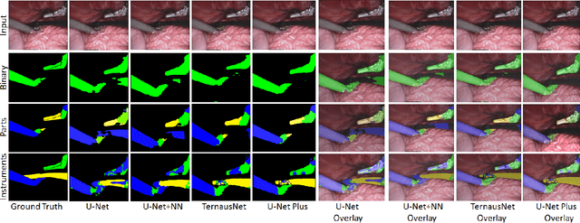 Figure 4 for U-NetPlus: A Modified Encoder-Decoder U-Net Architecture for Semantic and Instance Segmentation of Surgical Instrument
