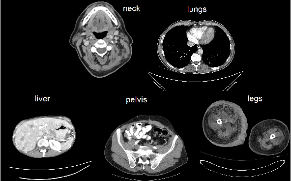 Figure 1 for Anatomy-specific classification of medical images using deep convolutional nets