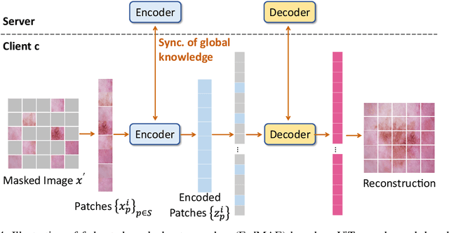 Figure 4 for Federated Self-Supervised Contrastive Learning and Masked Autoencoder for Dermatological Disease Diagnosis