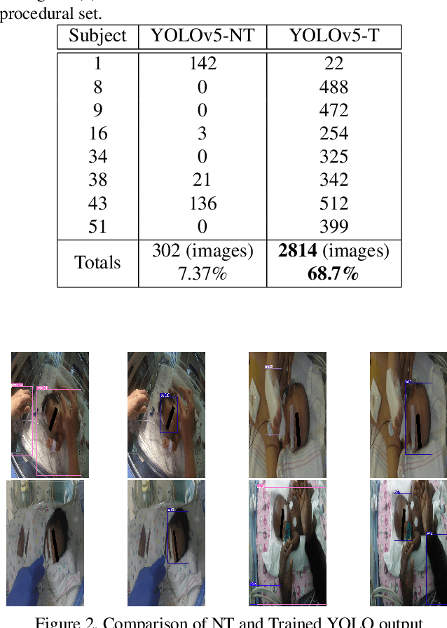 Figure 2 for Robust Neonatal Face Detection in Real-world Clinical Settings