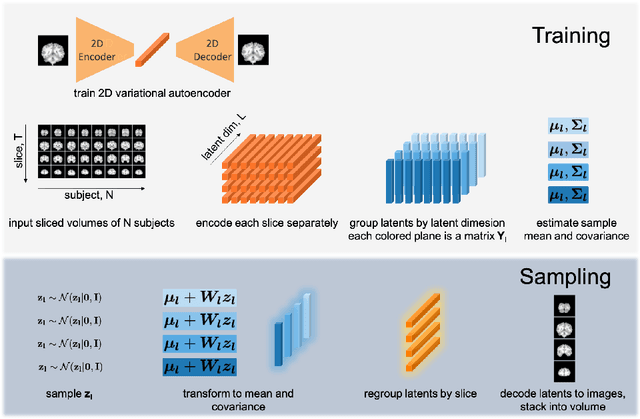 Figure 1 for Modelling the Distribution of 3D Brain MRI using a 2D Slice VAE