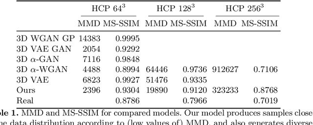 Figure 2 for Modelling the Distribution of 3D Brain MRI using a 2D Slice VAE