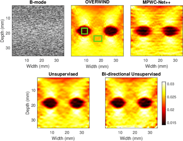 Figure 3 for Bi-Directional Semi-Supervised Training of Convolutional Neural Networks for Ultrasound Elastography Displacement Estimation