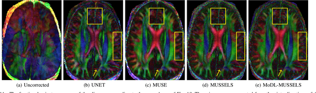 Figure 3 for Multi-Shot Sensitivity-Encoded Diffusion MRI using Model-Based Deep Learning (MODL-MUSSELS)