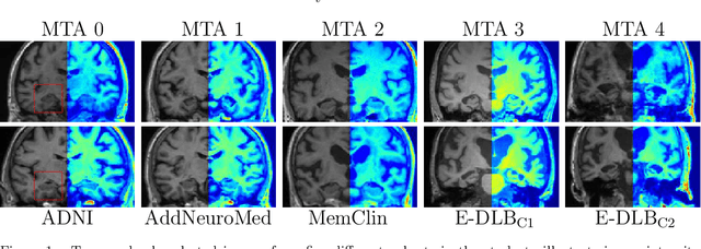 Figure 1 for The reliability of a deep learning model in clinical out-of-distribution MRI data: a multicohort study