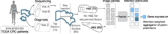 Figure 1 for Attention-based Interpretable Regression of Gene Expression in Histology