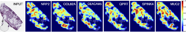 Figure 3 for Attention-based Interpretable Regression of Gene Expression in Histology