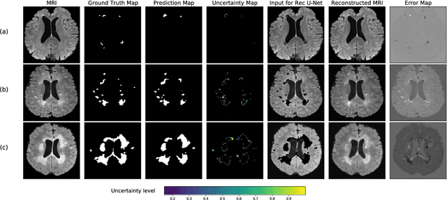 Figure 1 for Quality control for more reliable integration of deep learning-based image segmentation into medical workflows