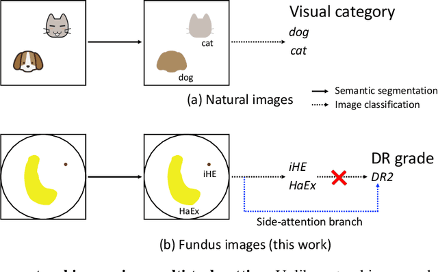 Figure 1 for Learn to Segment Retinal Lesions and Beyond