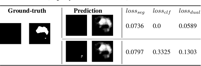 Figure 4 for Learn to Segment Retinal Lesions and Beyond