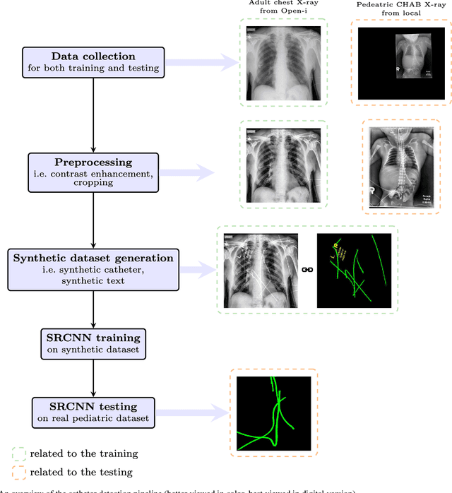 Figure 2 for Automatic catheter detection in pediatric X-ray images using a scale-recurrent network and synthetic data