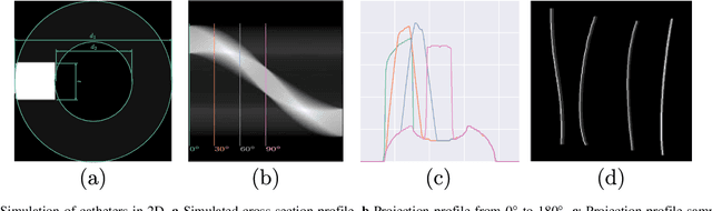 Figure 3 for Automatic catheter detection in pediatric X-ray images using a scale-recurrent network and synthetic data
