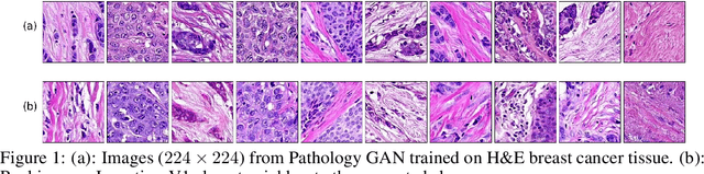 Figure 1 for Pathology GAN: Learning deep representations of cancer tissue