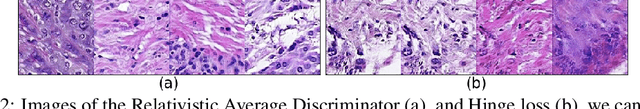 Figure 3 for Pathology GAN: Learning deep representations of cancer tissue