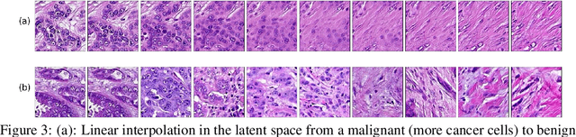 Figure 4 for Pathology GAN: Learning deep representations of cancer tissue