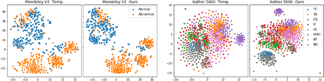 Figure 4 for Improved Trainable Calibration Method for Neural Networks on Medical Imaging Classification