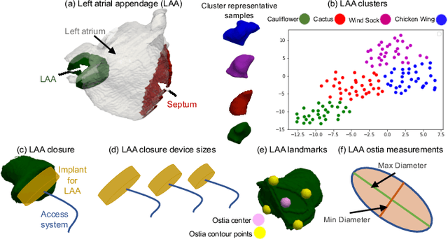 Figure 4 for Benchmarking off-the-shelf statistical shape modeling tools in clinical applications