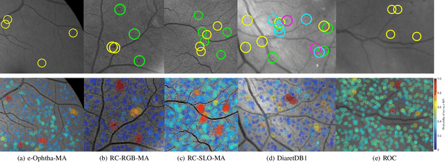 Figure 3 for Retinal Microaneurysms Detection using Local Convergence Index Features