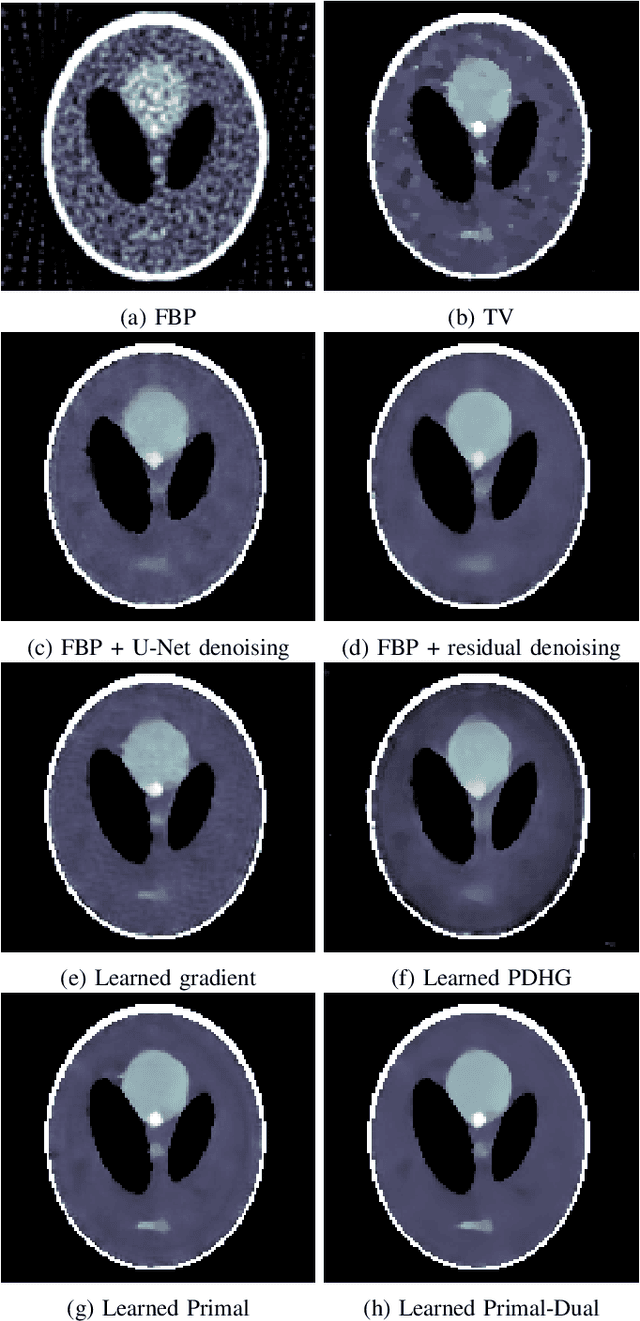 Figure 3 for Learned Primal-dual Reconstruction