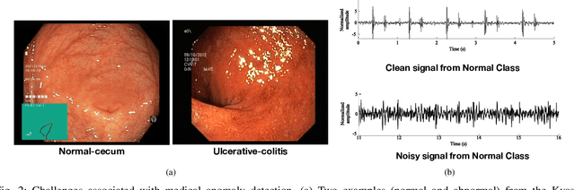 Figure 2 for Deep Learning for Medical Anomaly Detection -- A Survey