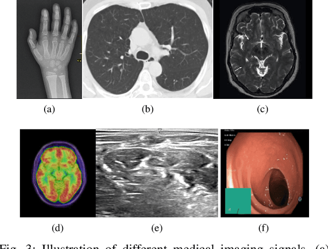 Figure 3 for Deep Learning for Medical Anomaly Detection -- A Survey