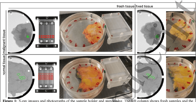 Figure 1 for Measurement of breast-tissue x-ray attenuation by spectral imaging: fresh and fixed normal and malignant tissue