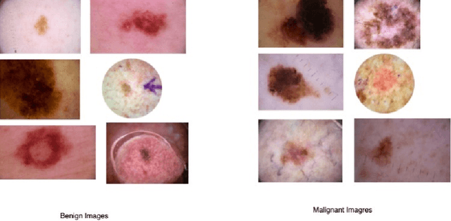 Figure 3 for Transfer Learning with Ensembles of Deep Neural Networks for Skin Cancer Classification in Imbalanced Data Sets
