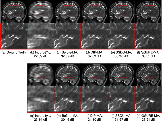 Figure 4 for Model Adaptation for Image Reconstruction using Generalized Stein's Unbiased Risk Estimator