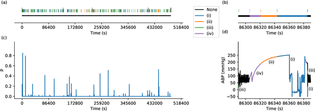 Figure 3 for DeepClean -- self-supervised artefact rejection for intensive care waveform data using generative deep learning