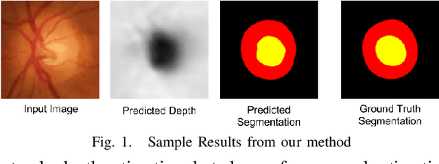 Figure 1 for Monocular Retinal Depth Estimation and Joint Optic Disc and Cup Segmentation using Adversarial Networks