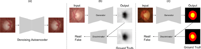 Figure 2 for Monocular Retinal Depth Estimation and Joint Optic Disc and Cup Segmentation using Adversarial Networks